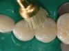 Figure 18  A Jiffy brush was used to facilitate polishing in between the spaces of the teeth, as well as over the surface anatomy developed when creating the restorations.