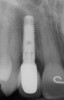 Figure 5h  Postoperative radiographs.