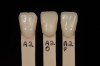 Figure 9  Custom composite shade guide tabs with three different finishing techniques applied.