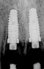 Figure 11   Initial view of resorbed maxillary central incisors.